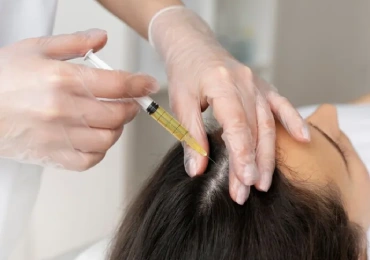 Hair Mesotherapy Treatment